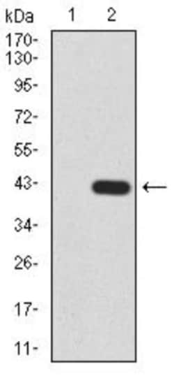 Histone Deacetylase 2/HDAC2 Antibody (4C10C3) - BSA Free, Novus Biologicals 0.1 mg | Buy Online | Novus Biologicals | Fisher Scientific